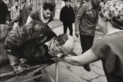 a-wounded-man-is-brought-to-kosovo-hospital-january-1994